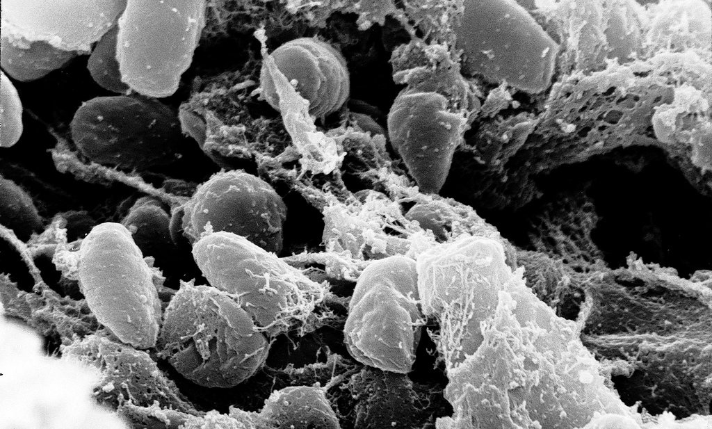 Leidse universiteit stelt vast dat bacteriën elkaar bestrijden