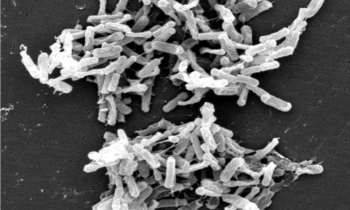 Clostridium difficile mogelijk verspreid via wereldhandel in varkensvlees