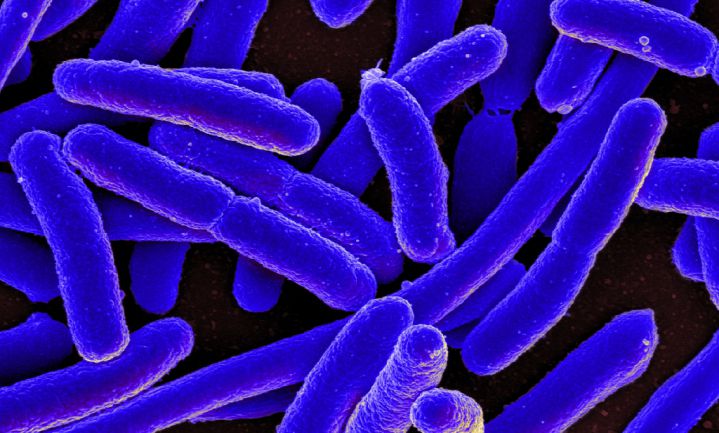 Kwart Britse supermarktkip bevat resistente E.coli