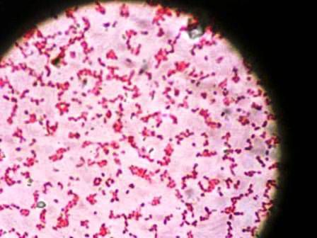 Minder Campylobacter-besmetting op pluimvee en vlees
