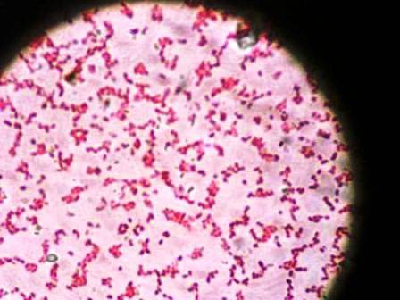 EFSA: Campylobacter-besmettingen stabiliseren