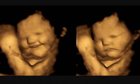 Eerste directe bewijs dat baby’s proeven in de baarmoeder