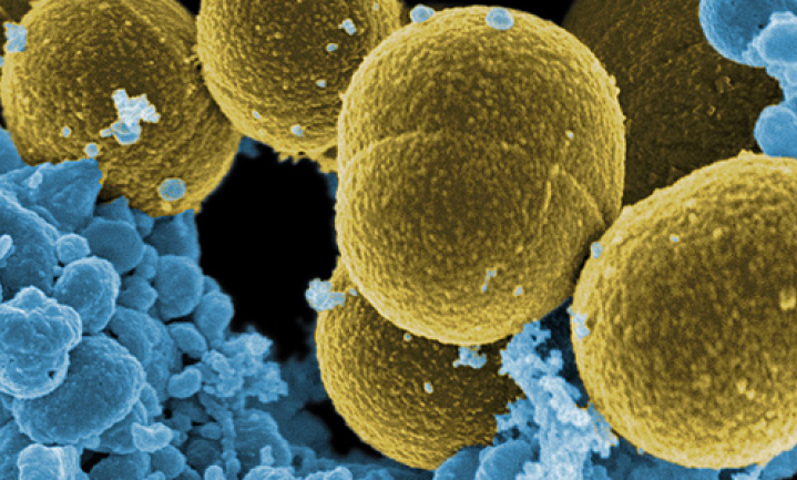 Wat doen antibiotica ons microbioom aan?